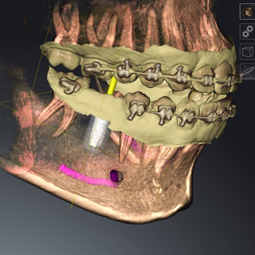 3D Cone Beam