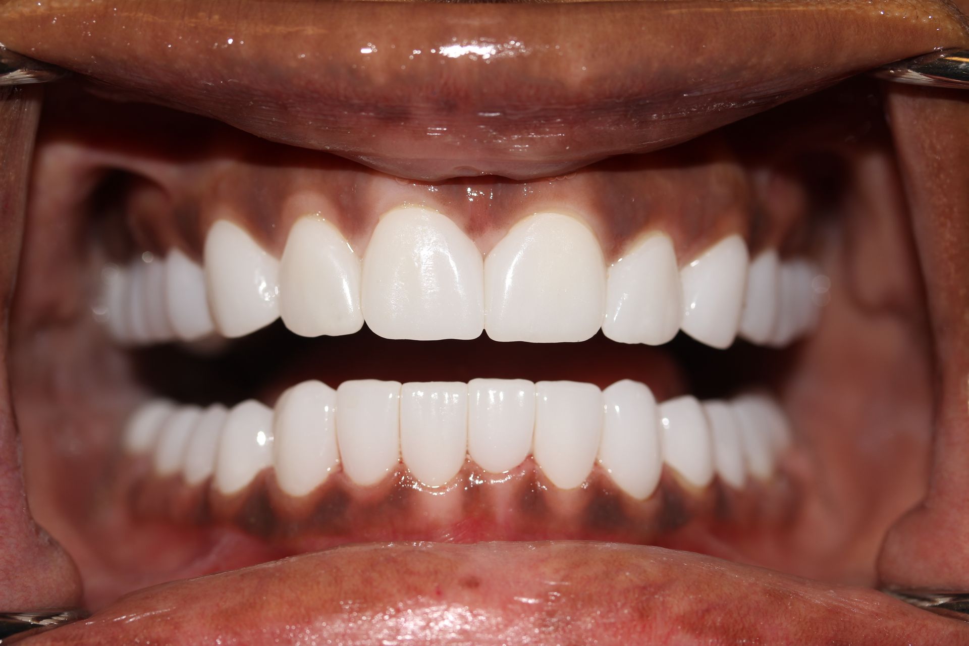 After treatment